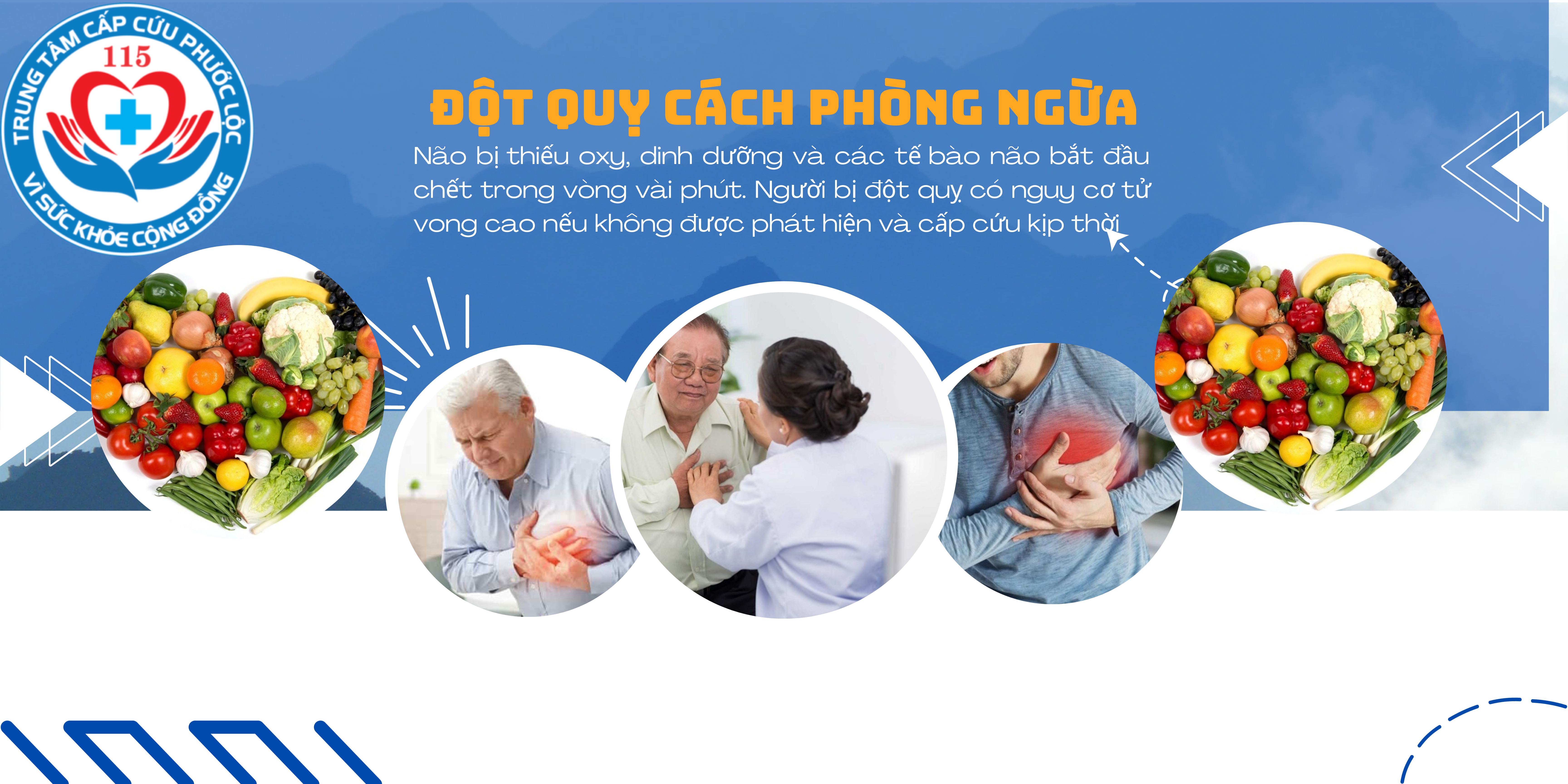 Đột quỵ:cách nhận biết,phòng ngừa và những loại thuốc hỗ trợ đột quỵ