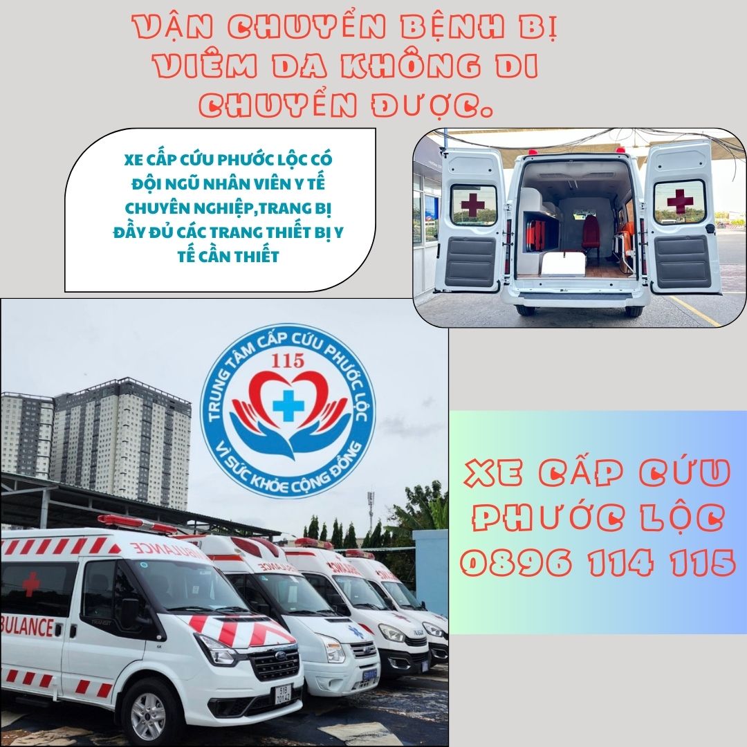 vận chuyển bệnh nhân bị viêm loét ngoài da bằng xe cấp cứu Phước Lộc 0896114115