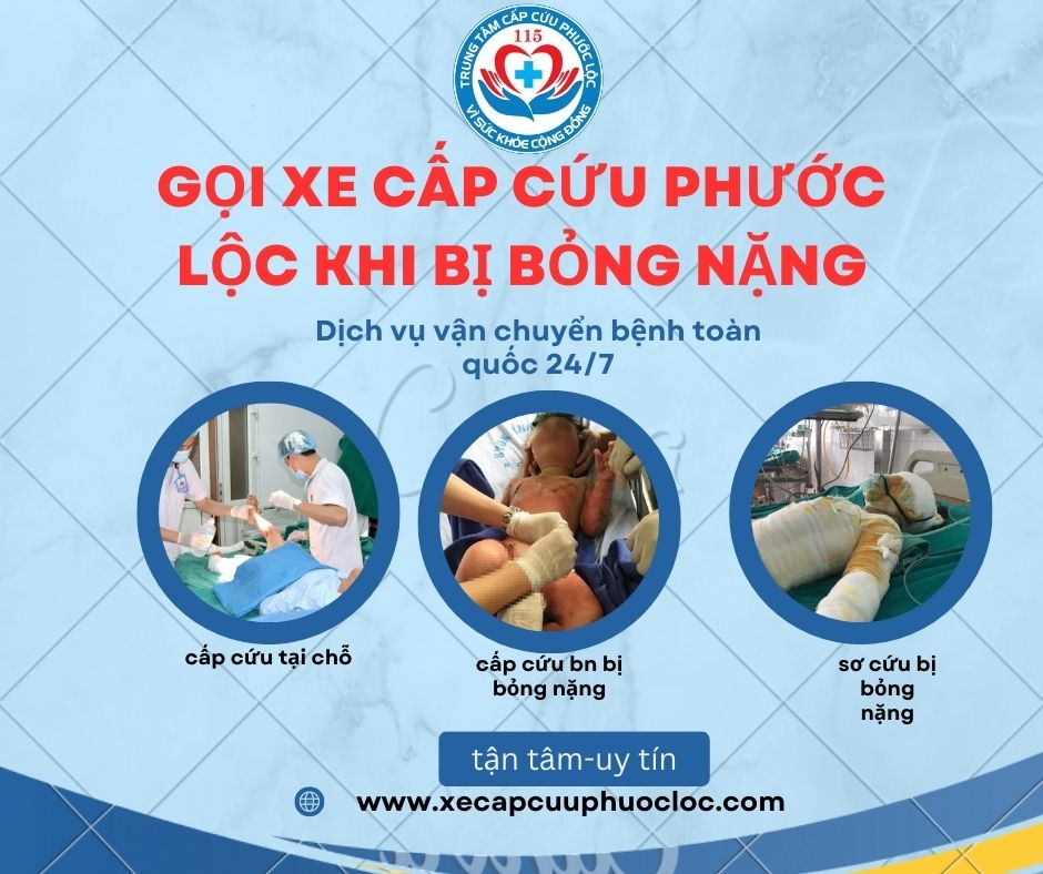 phát hiện người nhà bị bỏng nặng, hãy gọi ngay xe cấp cứu Phước Lộc 0896114115