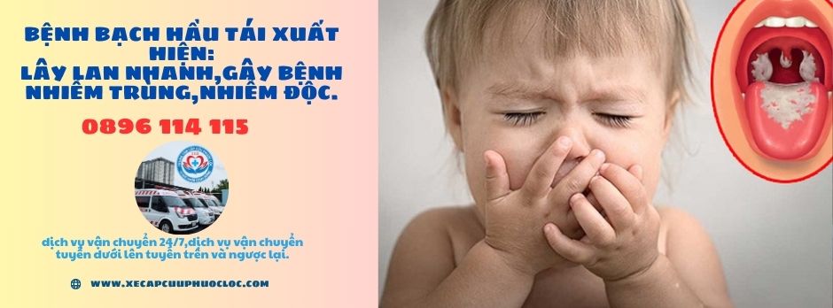 Cách điều trị bệnh bạch hầu