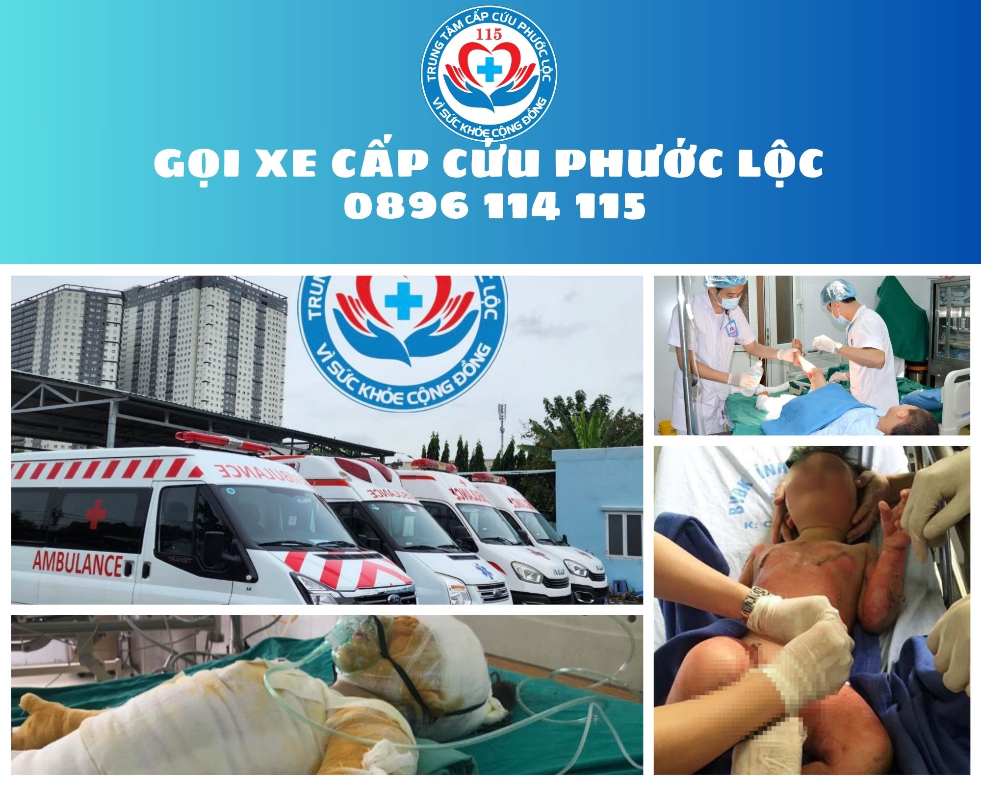 phát hiện người nhà bị bỏng nặng, hãy gọi ngay xe cấp cứu Phước Lộc